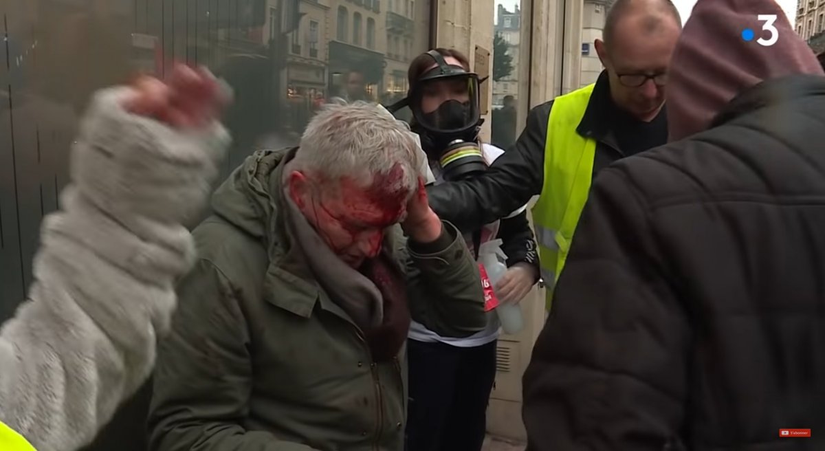 Αποτέλεσμα εικόνας για Manifestant blessé à la tête à Rouen